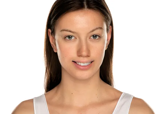 「スキン スムージング」と「スマートポートレート」を適用し、肌の質感を整え、少し微笑んだ表情に自然に変化させている。